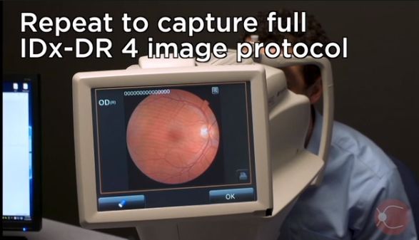 FDA首次批准一种AI诊断设备可通过视网膜照片来检测眼病
