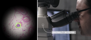 病理研究有新帮手，Google以AR显微镜结合深度学习即时发现癌细胞