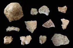 研究员竟然在距今7000年前的古人类遗骨上发现了乙肝病毒