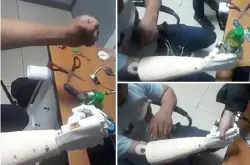 吉尔吉斯斯坦国立医院首次研发仿生义肢 可由大脑意念操控