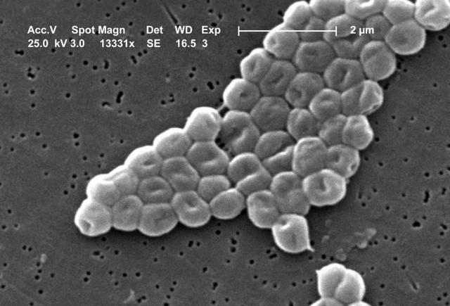 NASA遇难题：有些细菌太难被消灭靠吃清洁剂活着