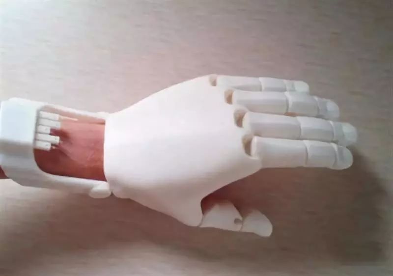 专为伤残人士设计 比真手还好用的3D打印假肢