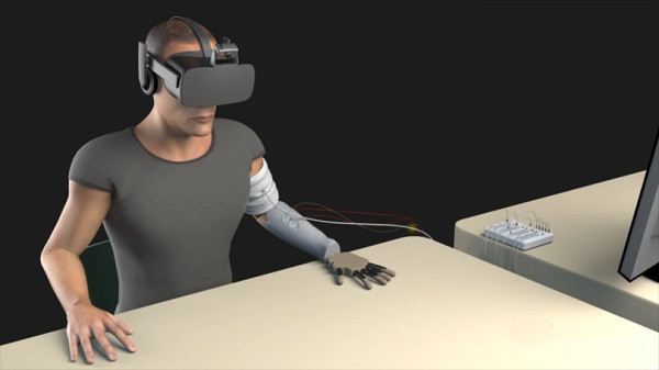 截肢患者福音 实验证实采用VR技术可有效帮助病人接受假肢