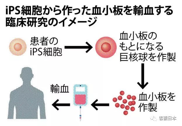日本iPS细胞研究报告(九)京都大学篇:申请血小板临床试验