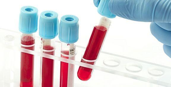 血检可测人体生物钟预防多种致命疾病
