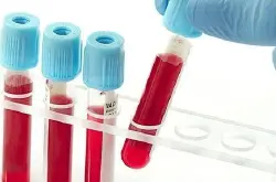 血检可测人体生物钟预防多种致命疾病