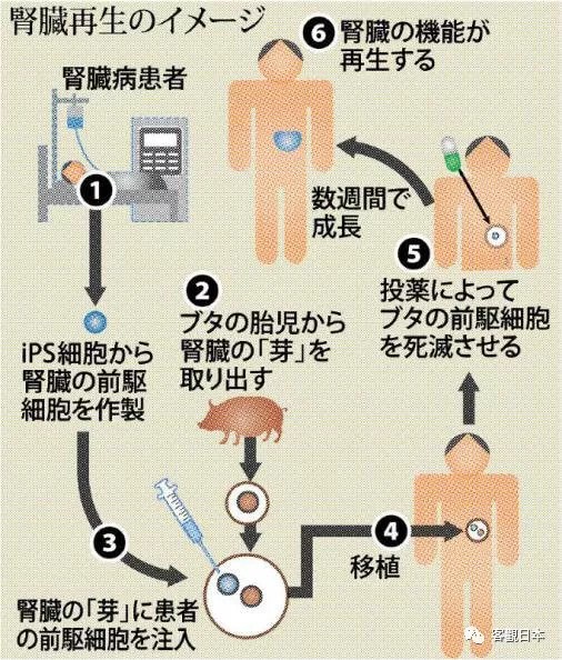 日本iPS细胞研究报告(十)慈惠医大篇：世界首次申请肾脏再生临床试验
