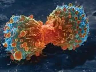 CancerCell：乳腺癌药物帕博西尼或能有效治疗急性髓性白血病