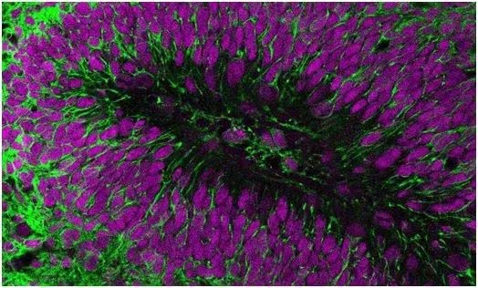 Science：将人脑细胞移植到小鼠大脑中有助深入认识唐氏综合症