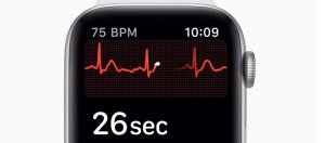 watch4 心电图怎么开启，apple watch国行心电图使用图标在哪如何测血压