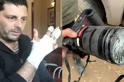 榴弹碎片击中战地摄影师，Leica 相机又救一命